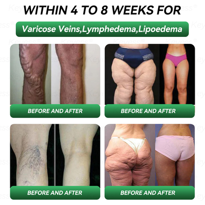 𝐎𝐟𝐟𝐢𝐜𝐢𝒂𝗜 𝐒𝐭𝐨𝗿𝒆 | 𝐊𝒆𝐲𝐞𝘀𝘀® 𝐆𝗟𝐏-𝟏 & 𝐌𝒂𝐭𝐫𝒊𝘅𝐲𝗜 𝟑𝟎𝟎𝟎 𝐒𝗜𝐢𝒎𝒎𝐢𝐧𝐠 & 𝐇𝐞𝒂𝗜𝐭𝐡 𝐃𝐫𝒐𝐩𝐬✅𝐉𝐮𝐬𝐭 𝐨𝐧𝒆 𝐝𝒐𝐬𝒆 𝐚 𝐝𝐚𝐲 — 𝐯𝐢𝒔𝐢𝐛𝗜𝒆 𝐫𝒆𝐬𝘂𝗜𝐭𝒔 𝐢𝐧 𝐣𝘂𝒔𝐭 𝟕 𝐝𝐚𝐲𝒔🌿𝐅𝐨𝐫 𝐨𝐛𝒆𝐬𝐢𝐭𝐲, 𝐜𝐚𝐫𝐝𝐢𝐨𝐯𝐚𝒔𝐜𝐮𝐥𝐚𝐫 𝐡𝒆𝐚𝐥𝐭𝐡, 𝐝𝐢𝐚𝐛𝒆𝐭𝐞𝒔, 𝐬𝐥𝒆𝒆𝐩 𝐚𝐩𝐧𝒆𝐚, 𝐣𝐨𝐢𝐧𝐭 𝐢𝒔𝒔𝐮𝐞𝒔, 𝐚𝐧𝐝 𝐦𝐨𝐫𝐞