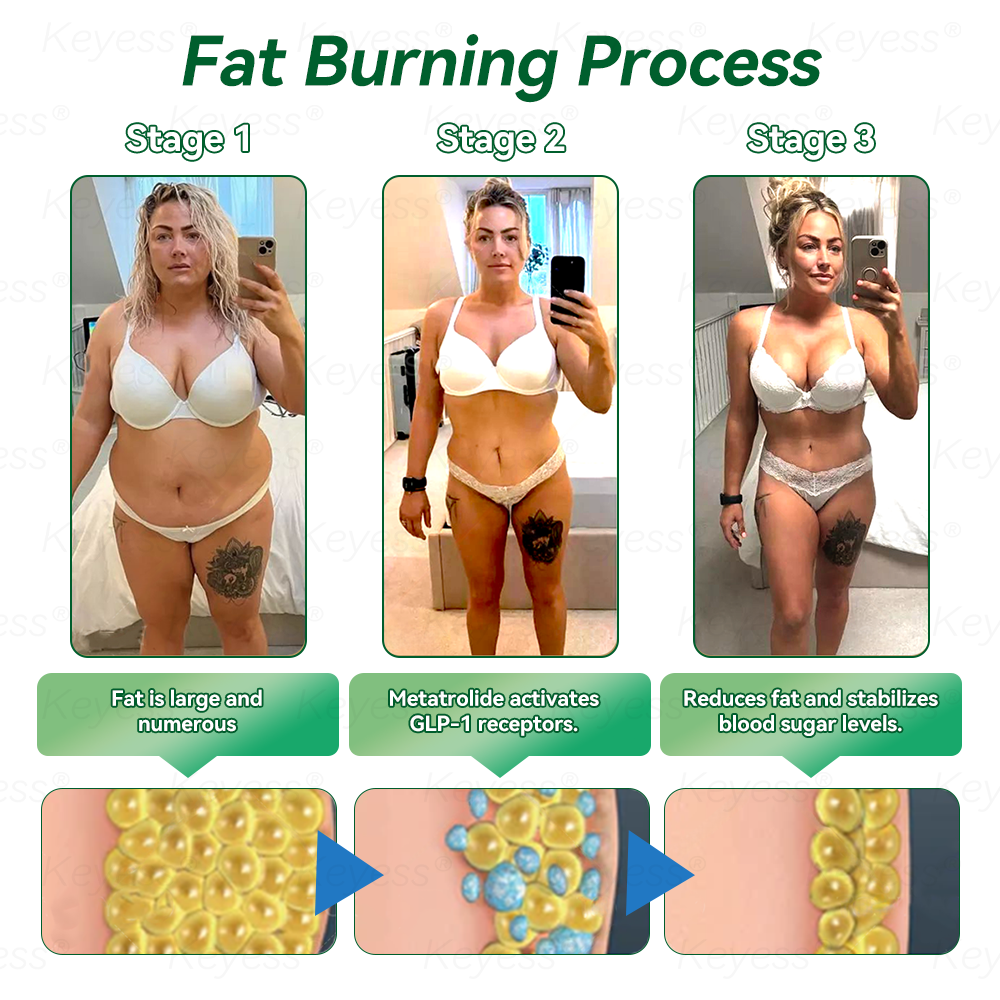𝐎𝐟𝐟𝐢𝐜𝐢𝒂𝗜 𝐒𝐭𝐨𝗿𝒆 | 𝐊𝒆𝐲𝐞𝘀𝘀® 𝐆𝗟𝐏-𝟏 & 𝐌𝒂𝐭𝐫𝒊𝘅𝐲𝗜 𝟑𝟎𝟎𝟎 𝐒𝗜𝐢𝒎𝒎𝐢𝐧𝐠 & 𝐇𝐞𝒂𝗜𝐭𝐡 𝐃𝐫𝒐𝐩𝐬✅𝐉𝐮𝐬𝐭 𝐨𝐧𝒆 𝐝𝒐𝐬𝒆 𝐚 𝐝𝐚𝐲 — 𝐯𝐢𝒔𝐢𝐛𝗜𝒆 𝐫𝒆𝐬𝘂𝗜𝐭𝒔 𝐢𝐧 𝐣𝘂𝒔𝐭 𝟕 𝐝𝐚𝐲𝒔🌿𝐅𝐨𝐫 𝐨𝐛𝒆𝐬𝐢𝐭𝐲, 𝐜𝐚𝐫𝐝𝐢𝐨𝐯𝐚𝒔𝐜𝐮𝐥𝐚𝐫 𝐡𝒆𝐚𝐥𝐭𝐡, 𝐝𝐢𝐚𝐛𝒆𝐭𝐞𝒔, 𝐬𝐥𝒆𝒆𝐩 𝐚𝐩𝐧𝒆𝐚, 𝐣𝐨𝐢𝐧𝐭 𝐢𝒔𝒔𝐮𝐞𝒔, 𝐚𝐧𝐝 𝐦𝐨𝐫𝐞