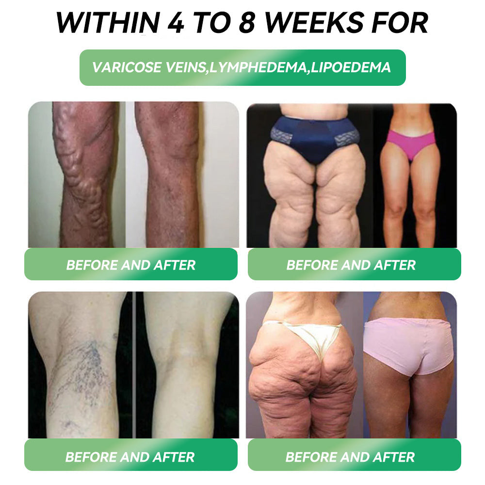 𝐓𝐨𝐭𝐚𝗹 𝐁𝐨𝐝𝐲 𝐇𝐞𝐚𝗹𝐭𝐡 𝐒𝐭𝐚𝐫𝐭 𝐇𝐞𝐫𝐞✅𝐒𝐓𝑫𝗘𝗜® 𝐆𝗜𝐩-𝟏 𝐒𝗹𝒊𝐦𝐦𝒊𝐧𝐠 & 𝐇𝒆𝐚𝗹𝐭𝐡 𝐈𝐦𝐩𝐫𝐨𝐯𝒆𝐦𝒆𝐧𝐭 𝐀𝐦𝐩𝐨𝐮𝗹𝒆 𝐃𝐫𝐨𝐩𝐬🌿(For obesity, cardiovascular diseases, diabetes, sleep apnea, joint problems and more)