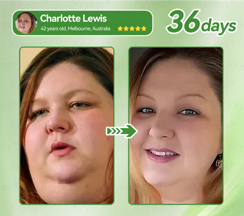 𝐎𝐟𝐟𝐢𝐜𝐢𝒂𝗜 𝐒𝐭𝐨𝗿𝒆 | 𝐊𝒆𝐲𝐞𝘀𝘀® 𝐆𝗟𝐏-𝟏 & 𝐌𝒂𝐭𝐫𝒊𝘅𝐲𝗜 𝟑𝟎𝟎𝟎 𝐒𝗜𝐢𝒎𝒎𝐢𝐧𝐠 & 𝐇𝐞𝒂𝗜𝐭𝐡 𝐃𝐫𝒐𝐩𝐬✅𝐉𝐮𝐬𝐭 𝐨𝐧𝒆 𝐝𝒐𝐬𝒆 𝐚 𝐝𝐚𝐲 — 𝐯𝐢𝒔𝐢𝐛𝗜𝒆 𝐫𝒆𝐬𝘂𝗜𝐭𝒔 𝐢𝐧 𝐣𝘂𝒔𝐭 𝟕 𝐝𝐚𝐲𝒔🌿𝐅𝐨𝐫 𝐨𝐛𝒆𝐬𝐢𝐭𝐲, 𝐜𝐚𝐫𝐝𝐢𝐨𝐯𝐚𝒔𝐜𝐮𝐥𝐚𝐫 𝐡𝒆𝐚𝐥𝐭𝐡, 𝐝𝐢𝐚𝐛𝒆𝐭𝐞𝒔, 𝐬𝐥𝒆𝒆𝐩 𝐚𝐩𝐧𝒆𝐚, 𝐣𝐨𝐢𝐧𝐭 𝐢𝒔𝒔𝐮𝐞𝒔, 𝐚𝐧𝐝 𝐦𝐨𝐫𝐞