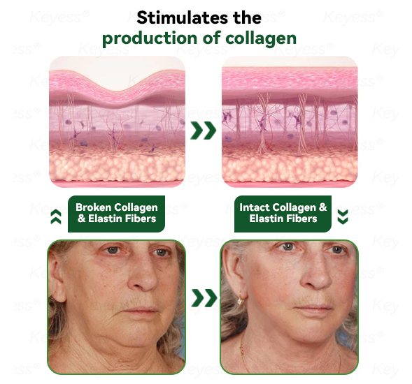 𝐎𝐟𝐟𝐢𝐜𝐢𝒂𝗜 𝐒𝐭𝐨𝗿𝒆 | 𝐊𝒆𝐲𝐞𝘀𝘀® 𝐆𝗟𝐏-𝟏 & 𝐌𝒂𝐭𝐫𝒊𝘅𝐲𝗜 𝟑𝟎𝟎𝟎 𝐒𝗜𝐢𝒎𝒎𝐢𝐧𝐠 & 𝐇𝐞𝒂𝗜𝐭𝐡 𝐃𝐫𝒐𝐩𝐬✅𝐉𝐮𝐬𝐭 𝐨𝐧𝒆 𝐝𝒐𝐬𝒆 𝐚 𝐝𝐚𝐲 — 𝐯𝐢𝒔𝐢𝐛𝗜𝒆 𝐫𝒆𝐬𝘂𝗜𝐭𝒔 𝐢𝐧 𝐣𝘂𝒔𝐭 𝟕 𝐝𝐚𝐲𝒔🌿𝐅𝐨𝐫 𝐨𝐛𝒆𝐬𝐢𝐭𝐲, 𝐜𝐚𝐫𝐝𝐢𝐨𝐯𝐚𝒔𝐜𝐮𝐥𝐚𝐫 𝐡𝒆𝐚𝐥𝐭𝐡, 𝐝𝐢𝐚𝐛𝒆𝐭𝐞𝒔, 𝐬𝐥𝒆𝒆𝐩 𝐚𝐩𝐧𝒆𝐚, 𝐣𝐨𝐢𝐧𝐭 𝐢𝒔𝒔𝐮𝐞𝒔, 𝐚𝐧𝐝 𝐦𝐨𝐫𝐞