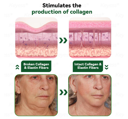 𝐎𝐟𝐟𝐢𝐜𝐢𝒂𝗜 𝐒𝐭𝐨𝗿𝒆 | 𝐊𝒆𝐲𝐞𝘀𝘀® 𝐆𝗟𝐏-𝟏 & 𝐌𝒂𝐭𝐫𝒊𝘅𝐲𝗜 𝟑𝟎𝟎𝟎 𝐒𝗜𝐢𝒎𝒎𝐢𝐧𝐠 & 𝐇𝐞𝒂𝗜𝐭𝐡 𝐃𝐫𝒐𝐩𝐬✅𝐉𝐮𝐬𝐭 𝐨𝐧𝒆 𝐝𝒐𝐬𝒆 𝐚 𝐝𝐚𝐲 — 𝐯𝐢𝒔𝐢𝐛𝗜𝒆 𝐫𝒆𝐬𝘂𝗜𝐭𝒔 𝐢𝐧 𝐣𝘂𝒔𝐭 𝟕 𝐝𝐚𝐲𝒔🌿𝐅𝐨𝐫 𝐨𝐛𝒆𝐬𝐢𝐭𝐲, 𝐜𝐚𝐫𝐝𝐢𝐨𝐯𝐚𝒔𝐜𝐮𝐥𝐚𝐫 𝐡𝒆𝐚𝐥𝐭𝐡, 𝐝𝐢𝐚𝐛𝒆𝐭𝐞𝒔, 𝐬𝐥𝒆𝒆𝐩 𝐚𝐩𝐧𝒆𝐚, 𝐣𝐨𝐢𝐧𝐭 𝐢𝒔𝒔𝐮𝐞𝒔, 𝐚𝐧𝐝 𝐦𝐨𝐫𝐞