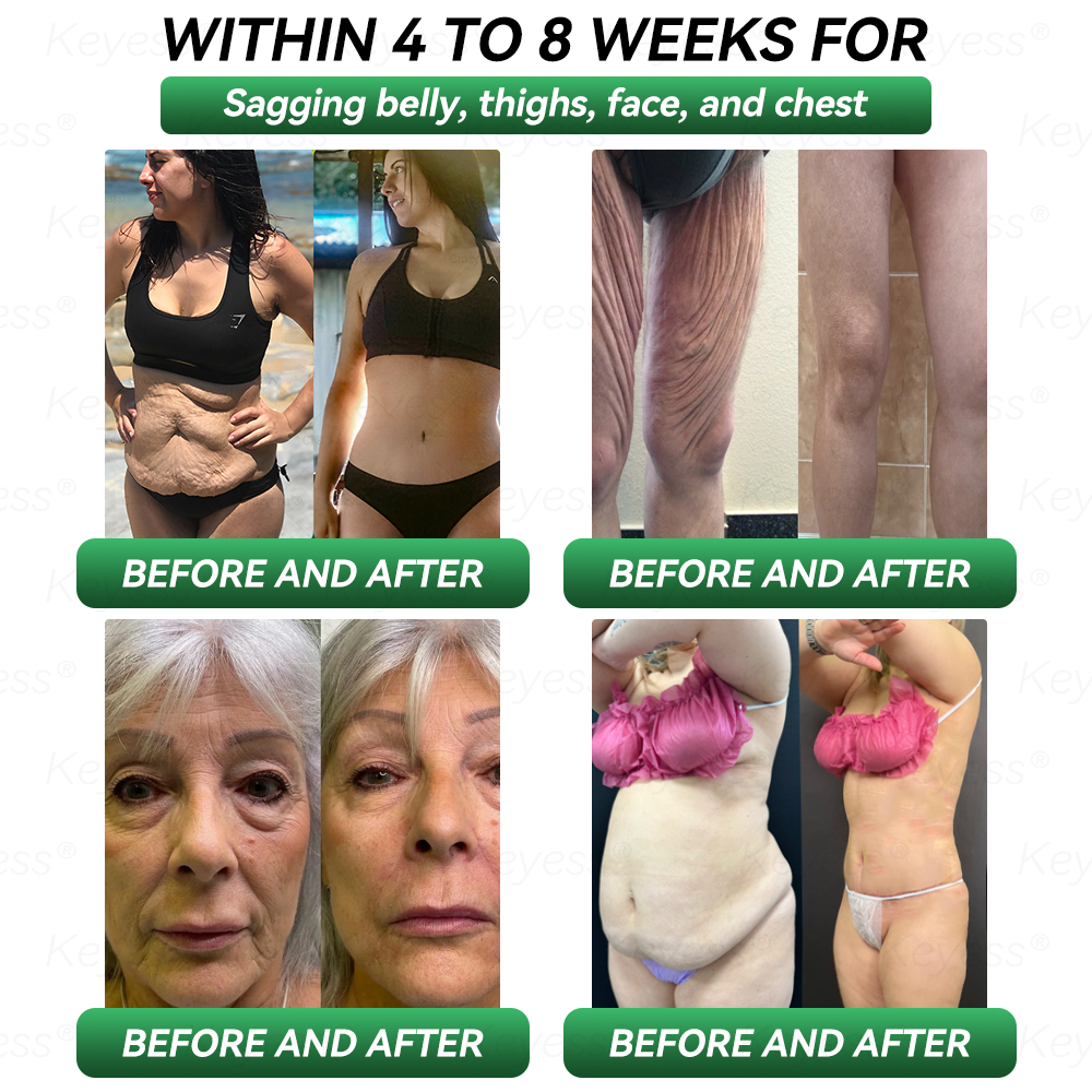 𝐎𝐟𝐟𝐢𝐜𝐢𝒂𝗜 𝐒𝐭𝐨𝗿𝒆 | 𝐊𝒆𝐲𝐞𝘀𝘀® 𝐆𝗟𝐏-𝟏 & 𝐌𝒂𝐭𝐫𝒊𝘅𝐲𝗜 𝟑𝟎𝟎𝟎 𝐒𝗜𝐢𝒎𝒎𝐢𝐧𝐠 & 𝐇𝐞𝒂𝗜𝐭𝐡 𝐃𝐫𝒐𝐩𝐬✅𝐉𝐮𝐬𝐭 𝐨𝐧𝒆 𝐝𝒐𝐬𝒆 𝐚 𝐝𝐚𝐲 — 𝐯𝐢𝒔𝐢𝐛𝗜𝒆 𝐫𝒆𝐬𝘂𝗜𝐭𝒔 𝐢𝐧 𝐣𝘂𝒔𝐭 𝟕 𝐝𝐚𝐲𝒔🌿𝐅𝐨𝐫 𝐨𝐛𝒆𝐬𝐢𝐭𝐲, 𝐜𝐚𝐫𝐝𝐢𝐨𝐯𝐚𝒔𝐜𝐮𝐥𝐚𝐫 𝐡𝒆𝐚𝐥𝐭𝐡, 𝐝𝐢𝐚𝐛𝒆𝐭𝐞𝒔, 𝐬𝐥𝒆𝒆𝐩 𝐚𝐩𝐧𝒆𝐚, 𝐣𝐨𝐢𝐧𝐭 𝐢𝒔𝒔𝐮𝐞𝒔, 𝐚𝐧𝐝 𝐦𝐨𝐫𝐞
