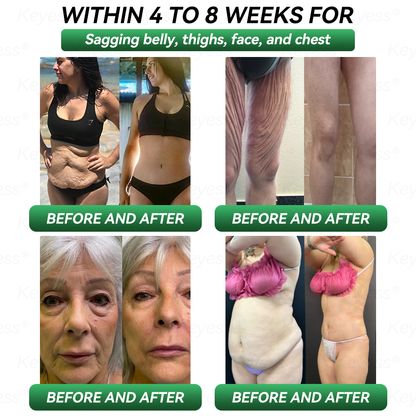 𝐎𝐟𝐟𝐢𝐜𝐢𝒂𝗜 𝐒𝐭𝐨𝗿𝒆 | 𝐊𝒆𝐲𝐞𝘀𝘀® 𝐆𝗟𝐏-𝟏 & 𝐌𝒂𝐭𝐫𝒊𝘅𝐲𝗜 𝟑𝟎𝟎𝟎 𝐒𝗜𝐢𝒎𝒎𝐢𝐧𝐠 & 𝐇𝐞𝒂𝗜𝐭𝐡 𝐃𝐫𝒐𝐩𝐬✅𝐉𝐮𝐬𝐭 𝐨𝐧𝒆 𝐝𝒐𝐬𝒆 𝐚 𝐝𝐚𝐲 — 𝐯𝐢𝒔𝐢𝐛𝗜𝒆 𝐫𝒆𝐬𝘂𝗜𝐭𝒔 𝐢𝐧 𝐣𝘂𝒔𝐭 𝟕 𝐝𝐚𝐲𝒔🌿𝐅𝐨𝐫 𝐨𝐛𝒆𝐬𝐢𝐭𝐲, 𝐜𝐚𝐫𝐝𝐢𝐨𝐯𝐚𝒔𝐜𝐮𝐥𝐚𝐫 𝐡𝒆𝐚𝐥𝐭𝐡, 𝐝𝐢𝐚𝐛𝒆𝐭𝐞𝒔, 𝐬𝐥𝒆𝒆𝐩 𝐚𝐩𝐧𝒆𝐚, 𝐣𝐨𝐢𝐧𝐭 𝐢𝒔𝒔𝐮𝐞𝒔, 𝐚𝐧𝐝 𝐦𝐨𝐫𝐞